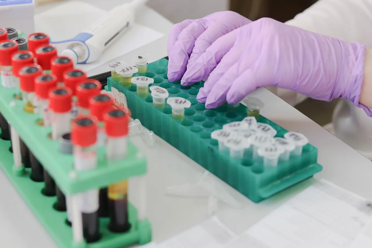 laboratory, medical, medicine, ręka, research, lab, test, doctor, equipment, scientist, kobieta, chemistry, science, hospital, experiment, osoba, technician, technology, healthcare, praca, health, tube, work, research lab, blood samples, laboratory, laboratory, laboratory, lab, lab, lab, doctor, doctor, doctor, doctor, doctor, hospital