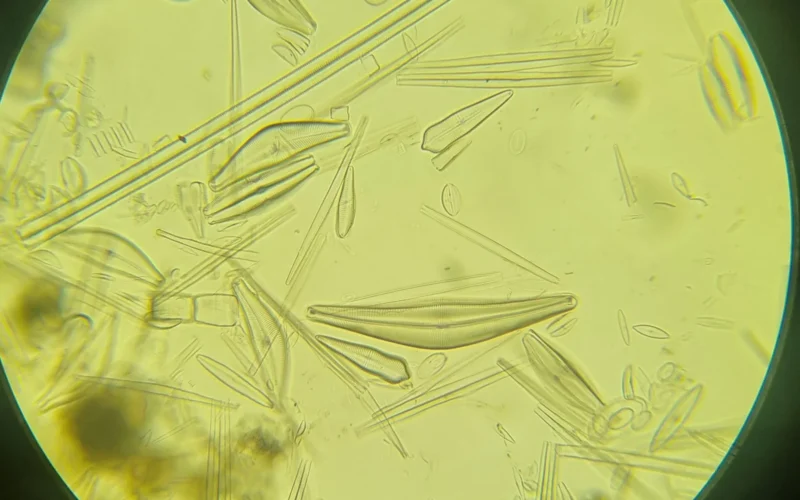 The diatom identified as Cymbella sp. presents the characteristic dorsiventral asymmetry that defines the genus, with a distinctly arched dorsal margin and a correspondingly flatter ventral margin, producing a gently curved, asymmetrical valve outline. The apices are typically rostrate to subrostrate, and the central area is expanded dorsally, forming a unilateral or irregularly rounded hyaline zone that is taxonomically informative. The raphe is strongly lateral, displaced toward the ventral margin, and exhibits a subtle sigmoid course, while the proximal raphe endings curve dorsally in a manner consistent with the genus’s diagnostic features. The striae are radiate to convergent and composed of fine, often elongated areolae that contribute to the delicate but structurally coherent silica frustule. Ecologically, Cymbella species are frequently associated with clean, moderately flowing freshwater habitats where they colonize macrophytes, stones, and submerged woody substrates as part of the periphytic community. Contemporary studies employing molecular and ultrastructural analyses have revealed substantial cryptic diversity within the genus and have shown that valve morphology can exhibit significant plasticity under differing nutrient regimes, light intensities, and hydrodynamic conditions. Moreover, Cymbella taxa are increasingly recognized as sensitive indicators of water quality, particularly with respect to organic pollution, ionic composition, and habitat stability. Through its distinctive morphology, ecological preferences, and indicative value, Cymbella stands as a crucial genus in both modern biomonitoring and paleolimnological research.