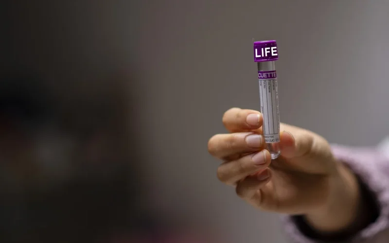test tube, rurka, laboratory, lab, science, medical, rodzić, chemistry, laboratory, laboratory, laboratory, laboratory, lab, lab, lab, lab, lab