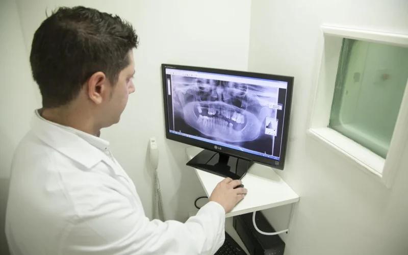 rtg żuchwy, żuchwa, odontologia, medycyna, zdrowie, pielęgniarstwo, szpital, lekarz, sala operacyjna, pielęgniarka, professional, lekarz, lekarz, lekarz, lekarz, lekarz